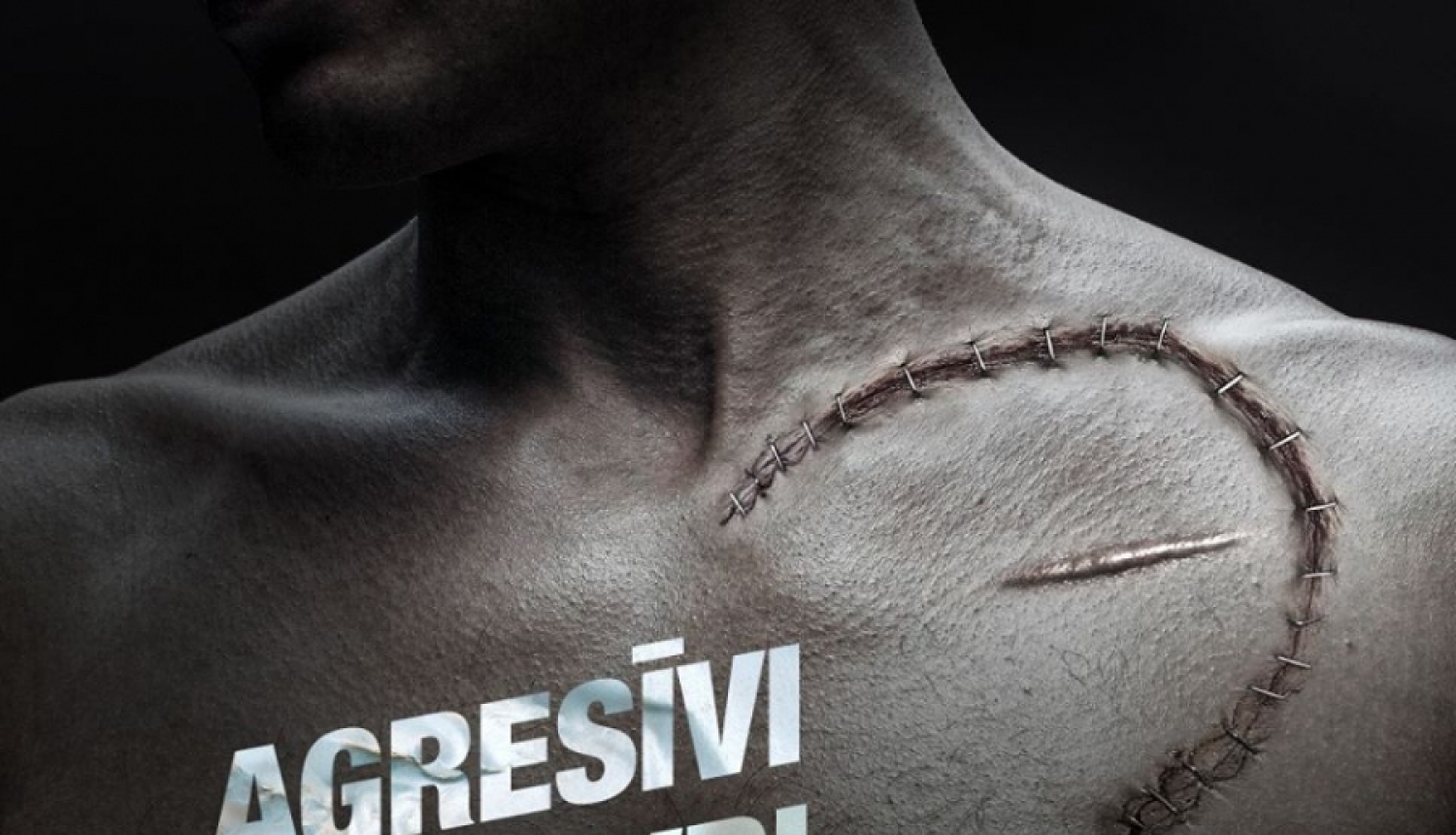 NMPD un Valsts policija atgādina – negadījumos cieš ne tikai agresors, bet arī nevainīgi autobraucēji!